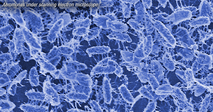 Scientific discovery a possible game changer in treatment of flesh-eating bacteria and other illnesses