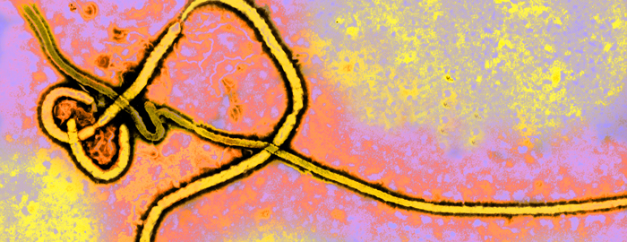 UTMB researchers develop Ebola treatment effective three days after infection