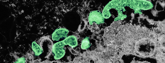 Researchers one step closer to countering deadly Nipah virus