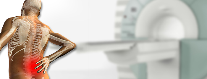 Study finds some physicians using unnecessary, potentially harmful imaging for acute lower back pain